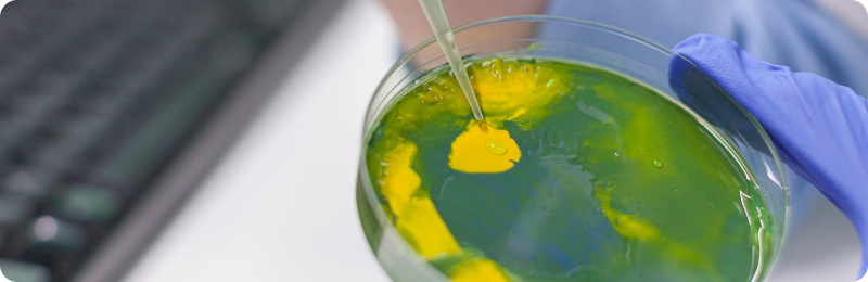 Культивирование анаэробных бактерий: выбор методов, анаэростаты и газогенерирующие пакеты